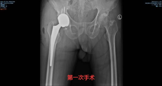 173141aapi299c1d9dg1im.png