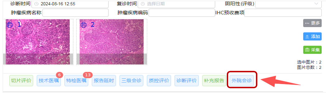 084609nhdcy8h322oh9cb9.png